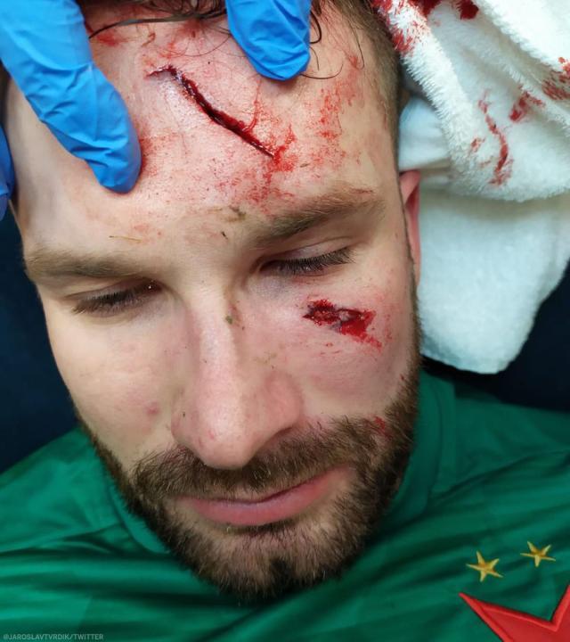 1616161091254033258.jpg 门将1.jpg